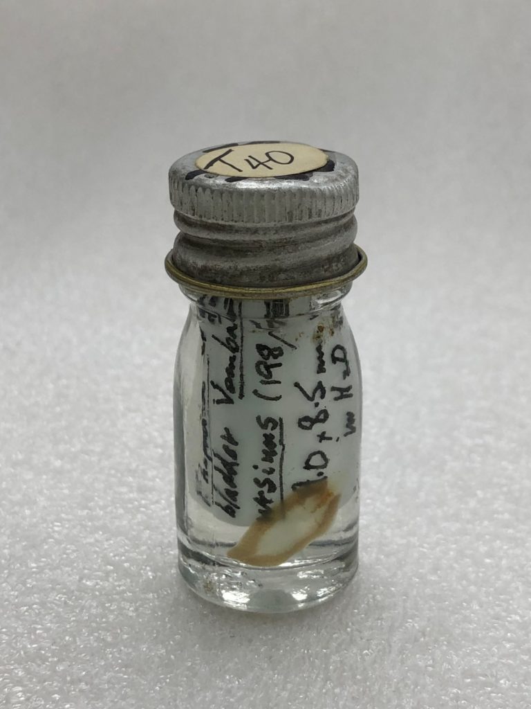 웜뱃의 담낭에서 채취한 기생충 (사진 CSIRO - Australian National Wildlife Collection)/뉴스펭귄